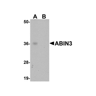 ABIN3 Peptide