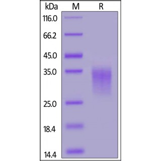 4-1BB / TNFRSF9 Recombinant Protein
