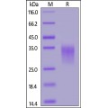 4-1BB / TNFRSF9 Recombinant Protein