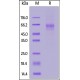 LIV-1 / SLC39A6 Recombinant Protein