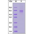 LIV-1 / SLC39A6 Recombinant Protein