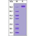 ENPP3 / CD203c Recombinant Protein