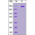 MERS S1 Recombinant Protein