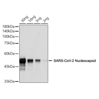 SARS-CoV-2 (COVID-19) Nucleocapsid Antibody [ARC2372]