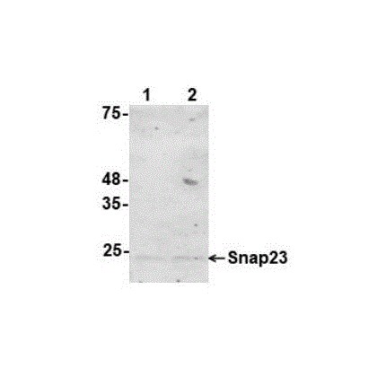 Synaptosomal-associated protein 23 Antibody [A6]