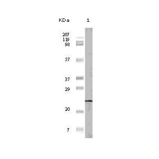 4E-BP1 Antibody [11G12C11]