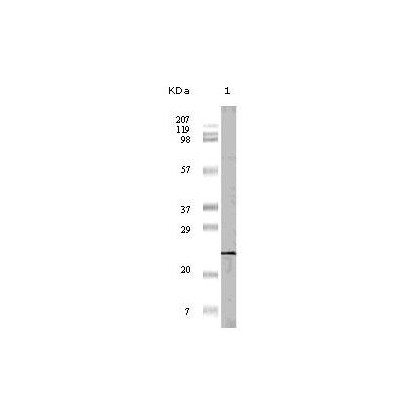 4E-BP1 Antibody [11G12C11]