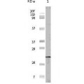 4E-BP1 Antibody [11G12C11]