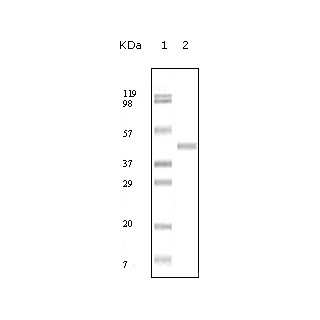 ABL2 Antibody [1H1B11]