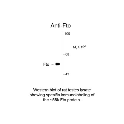 FTO ( Fat mass and obesity related protein) Antibody [5-2H10]