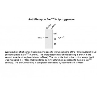 5 Lipoxygenase (phospho Ser523) Antibody