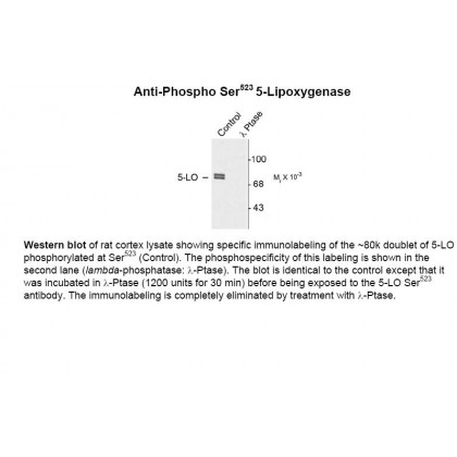 5 Lipoxygenase (phospho Ser523) Antibody