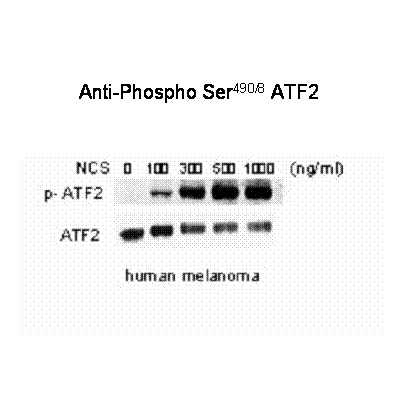 ATF2 (phospho Ser 490 / 498) Antibody